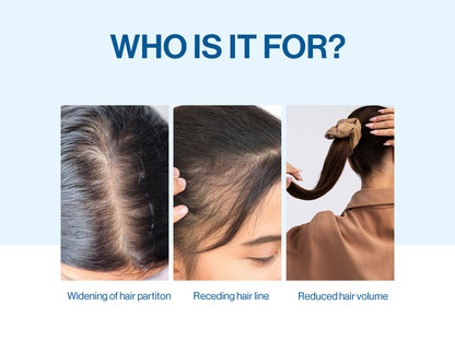 Be Bodywise Hair Growth Roll on Serum