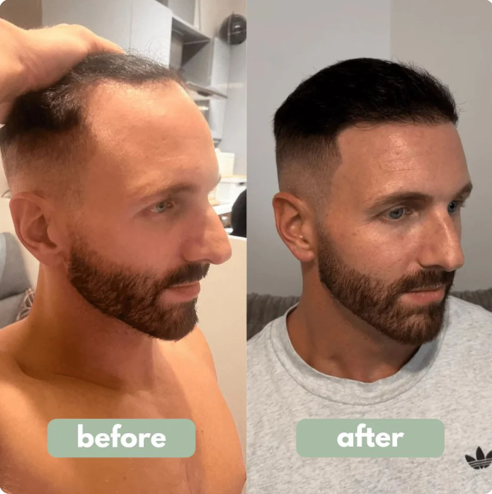 Rosemary Hair Growth Roll on Serum